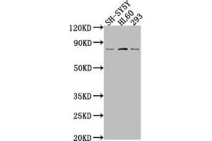 Western Blot Positive WB detected in: SH-SY5Y whole cell lysate, HL60 whole cell lysate, 293 whole cell lysate All lanes: CEACAM5 antibody at 1:2000 Secondary Goat polyclonal to rabbit IgG at 1/50000 dilution Predicted band size: 77 kDa Observed band size: 77 kDa (CEACAM5 抗体  (AA 1-255))