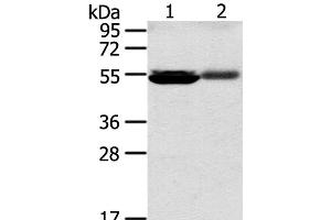 Western Blot analysis of Human kidney pericarcinous and kidney cancer tissue using SLC17A1 Polyclonal Antibody at dilution of 1:200 (SLC17A1 抗体)