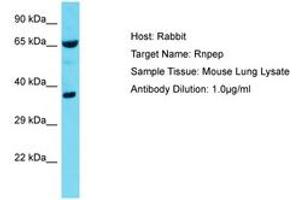 Image no. 1 for anti-Arginyl Aminopeptidase (Aminopeptidase B) (RNPEP) (AA 329-378) antibody (ABIN6750383) (RNPEP 抗体  (AA 329-378))