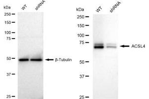 Western blotting analysis using ACSL4 antibody (ABIN7797498).