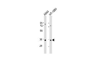 All lanes : Anti-RSPO3 Antibody (C-Term) at 1:2000 dilution Lane 1: A549 whole cell lysate Lane 2: HT-1080 whole cell lysate Lysates/proteins at 20 μg per lane. (R-Spondin 3 抗体  (AA 214-248))