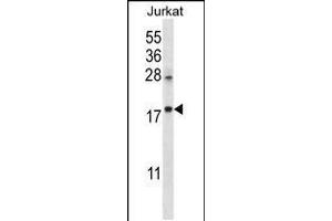 Western blot analysis in Jurkat cell line lysates (35ug/lane). (KRTAP25-1 抗体  (C-Term))