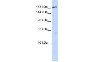 WB Suggested Anti-ABCC1 Antibody Titration:  0. (ABCC1 抗体  (Middle Region))