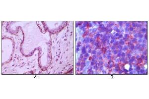 Immunohistochemical analysis of paraffin-embedded human breast ductal myoepithelium (A) and lymph tissue (B), showing cytoplasmic (A) and membrane (B) localization using CD10 mouse mAb with DAB staining (A) and AEC staining (B). (MME 抗体)