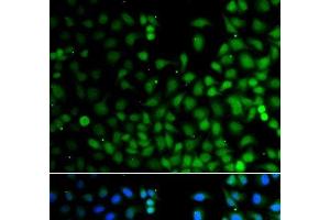 Immunofluorescence analysis of A549 cells using LHX6 Polyclonal Antibody (LHX6 抗体)
