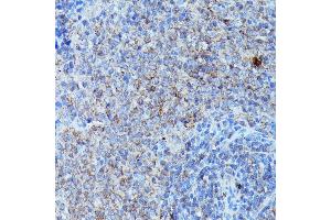 Immunohistochemistry of paraffin-embedded rat spleen using CSF3 antibody (ABIN6127710, ABIN6139100, ABIN6139101 and ABIN6221772) at dilution of 1:100 (40x lens).