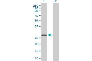 Western Blot analysis of ARHGDIA expression in transfected 293T cell line by ARHGDIA MaxPab polyclonal antibody. (ARHGDIA 抗体  (AA 1-204))