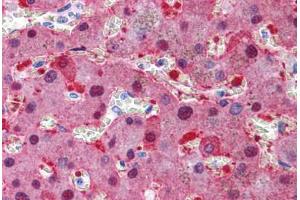 Human Liver: Formalin-Fixed, Paraffin-Embedded (FFPE) (CAD 抗体  (AA 1625-1900))