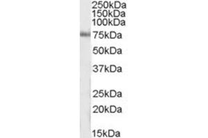 Western Blotting (WB) image for anti-Inositol-Trisphosphate 3-Kinase C (ITPKC) (Internal Region) antibody (ABIN2464190) (ITPKC 抗体  (Internal Region))