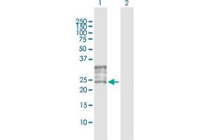 Western Blot analysis of FOLR1 expression in transfected 293T cell line by FOLR1 MaxPab polyclonal antibody. (FOLR1 抗体  (AA 1-257))