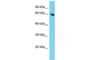 Host: Rabbit  Target Name: Nploc4  Sample Tissue: Mouse Testis lysates  Antibody Dilution: 1. (NPLOC4 抗体  (N-Term))
