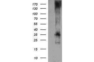 Western Blotting (WB) image for anti-T-cell surface glycoprotein CD1c (CD1C) antibody (ABIN2670658) (CD1c 抗体)