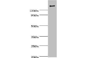 Western blot All lanes: ROCK2 antibody at 2 μg/mL + Rat brain tissue Secondary Goat polyclonal to rabbit IgG at 1/10000 dilution Predicted band size: 161 kDa Observed band size: 161 kDa (ROCK2 抗体  (AA 1109-1388))