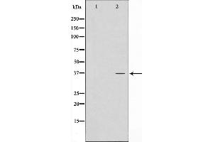 Western blot analysis on LOVO cell lysate using ATPBD3 Antibody，The lane on the left is treated with the antigen-specific peptide. (ATPBD3 抗体  (C-Term))