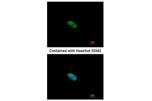 ICC/IF Image Immunofluorescence analysis of paraformaldehyde-fixed HeLa, using ZNF148, antibody at 1:500 dilution. (ZNF148 抗体  (N-Term))