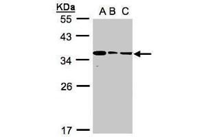 WB Image Sample(30 ug whole cell lysate) A:293T B:A431, C:H1299 12% SDS PAGE antibody diluted at 1:1000 (BPGM 抗体)