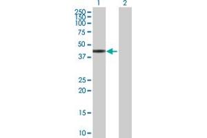 Western Blot analysis of ZNF331 expression in transfected 293T cell line by ZNF331 MaxPab polyclonal antibody. (ZNF331 抗体  (AA 1-463))