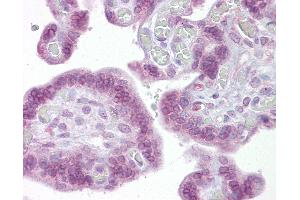 Anti-IRF6 antibody IHC of human placenta. (IRF6 抗体  (AA 395-444))
