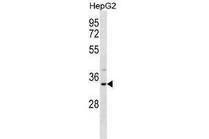 SULT1A3 Antibody (Center) western blot analysis in HepG2 cell line lysates (35µg/lane). (SULT1A3/1A4 抗体  (Middle Region))