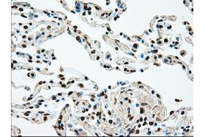 Image no. 2 for anti-Mitogen-Activated Protein Kinase Kinase 4 (MAP2K4) antibody (ABIN1499482) (MAP2K4 抗体)
