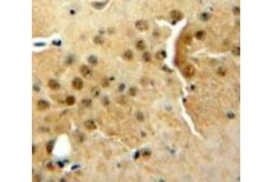 Used in DAB staining on fromalin fixed paraffin-embedded Brain tissue (DGKZ 抗体  (AA 695-932))