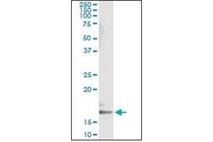 Western Blotting (WB) image for anti-Cytochrome b5 (CYTB5) (AA 1-135) antibody (ABIN951799)