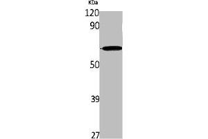 Western Blot analysis of K562 cells using IL-28Rα Polyclonal Antibody (IL28RA 抗体  (Internal Region))