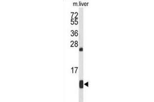 Western Blotting (WB) image for anti-Hemoglobin, alpha 2 (HBa2) antibody (ABIN2932211) (HBa2 抗体)