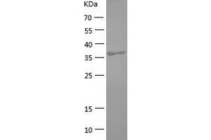 Western Blotting (WB) image for Complement Component (3b/4b) Receptor 1-Like (CR1L) (AA 41-405) protein (His tag) (ABIN7287582) (CR1L Protein (AA 41-405) (His tag))