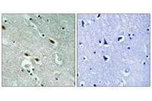 Immunohistochemistry analysis of paraffin-embedded human brain tissue using c-Met (Ab-1003) antiobdy. (c-MET 抗体  (Tyr1003))
