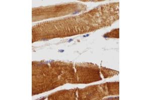 Immunohistochemical analysis of TITIN in Human skeletal muscle tissue sections(IHC-P - paraformaldehyde-fixed, paraffin-embedded sections). (Titin 抗体  (N-Term))