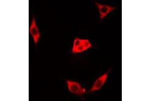 ABIN6273514 staining Hela cells by IF/ICC.