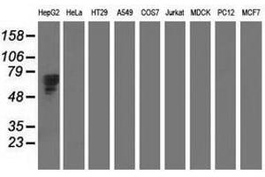 Image no. 2 for anti-alpha-Fetoprotein (AFP) antibody (ABIN1496490) (alpha Fetoprotein 抗体)