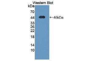 Western Blotting (WB) image for anti-Thioredoxin Interacting Protein (TXNIP) (AA 32-367) antibody (ABIN1871370)