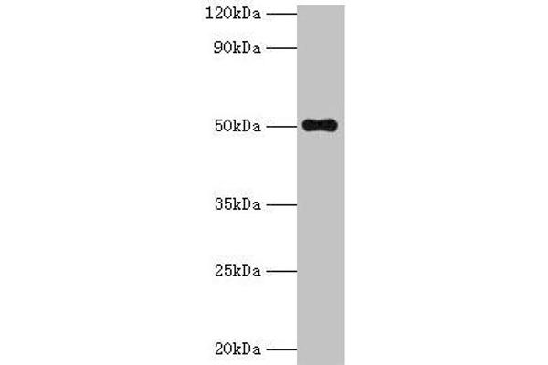 TMLHE 抗体  (AA 16-376)