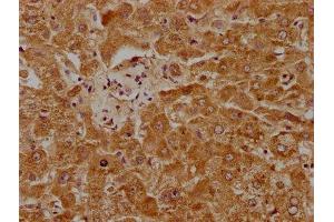 IHC image of ABIN7163540 diluted at 1:1000 and staining in paraffin-embedded human liver tissue performed on a Leica BondTM system.