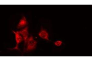 ABIN6275205 staining RAW264. (CEP97 抗体  (Internal Region))