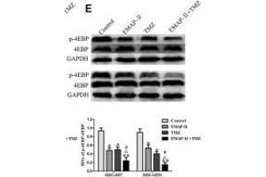 EMAP-II in combination with TMZ induced GSCs autophagy through MACC1 inhibiting PI3K/AKT/mTOR signaling pathway. (eIF4EBP1 抗体  (C-Term))