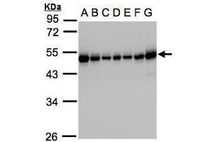 WB Image Sample(30μg whole cell lysate) A: 293T B: A431 , C: H1299 D: HeLa S3 , E: Hep G2 , F: MOLT4 , G: Raji , 10% SDS PAGE antibody diluted at 1:1000 (RCC1 抗体)