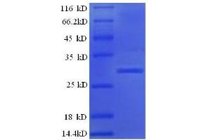 SDS-PAGE (SDS) image for Kallikrein B, Plasma (Fletcher Factor) 1 (KLKB1) (AA 391-638) protein (His tag) (ABIN7479020)