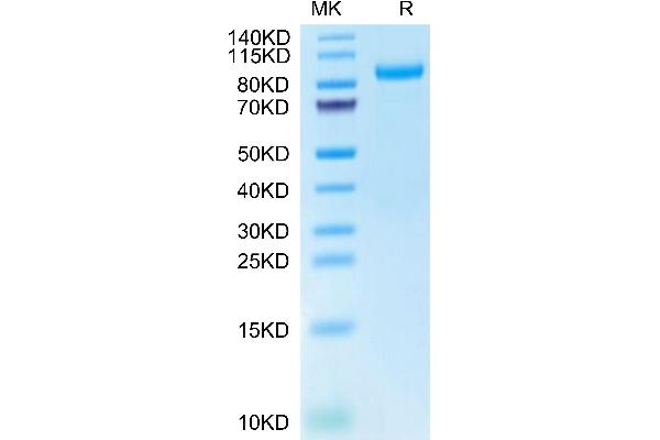 HGFA Protein (AA 34-650) (His tag)