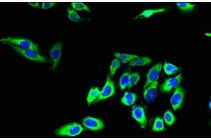 Immunofluorescent analysis of HepG2 cells using ABIN7147899 at dilution of 1:100 and Alexa Fluor 488-congugated AffiniPure Goat Anti-Rabbit IgG(H+L) (Claudin 2 抗体  (AA 29-81))