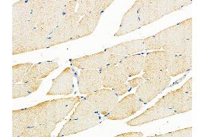 ABIN6259513 and ABIN6275914 at 1/100 staining Mouse muscle tissue by IHC-P. (Adenosine A3 Receptor 抗体  (C-Term))