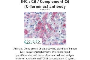 Image no. 2 for anti-Complement Component 6 (C6) antibody (ABIN1723410) (C6 抗体)
