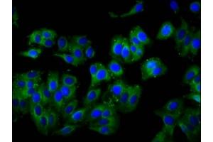Immunofluorescence staining of HepG2 cells with ABIN7175220 at 1:100, counter-stained with DAPI. (TCIRG1 抗体  (Isoform 3))