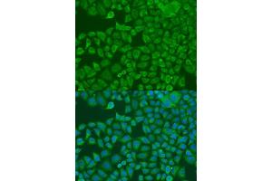 Immunofluorescence analysis of U2OS cells using FXR2 antibody. (FXR2 抗体  (AA 550-650))