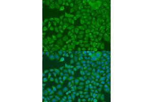 Immunofluorescence analysis of U2OS cells using FXR2 antibody. (FXR2 抗体  (AA 550-650))