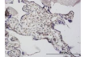 Image no. 4 for anti-Decapping Enzyme, Scavenger (DCPS) (AA 1-338) antibody (ABIN466201) (DCPS 抗体  (AA 1-338))