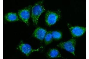IF analysis of GPR54/KISS1R using anti-GPR54/KISS1R antibody (ABIN7602153).