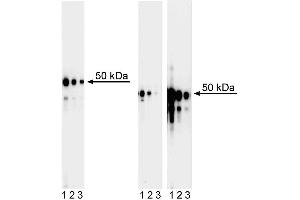 Western blot analysis of GATA3 in human T leukemia and mouse T helper cells. (GATA3 抗体)